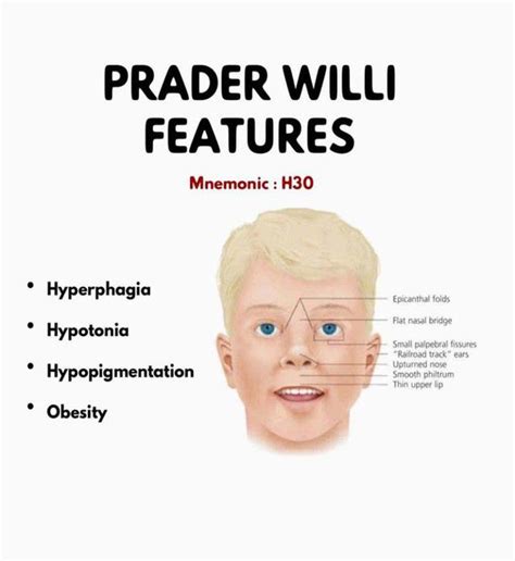 prada william syndroom|prader willi syndrome in adults.